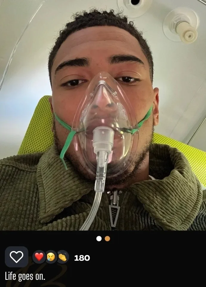 Tác động dây chuyền của chấn thương Bellingham